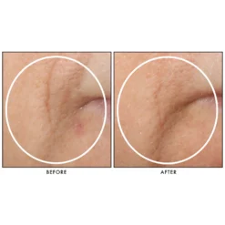 StriVectin Multi-Action Restorative Cream 50ml -Skincare Store 11277639 1844864735992774