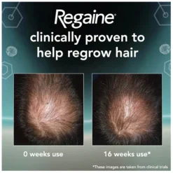 Regaine Men's Extra Strength Hair Loss And Hair Regrowth Scalp Foam Treatment 3 X 73ml -Skincare Store 11433831 8394931414598897