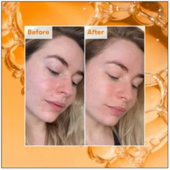 REN Clean Skincare Ready Steady Glow Daily AHA Tonic 250ml -Skincare Store 11653879 5814894570495782