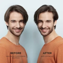 NIOXIN 3-Part System 2 Cleanser Shampoo For Natural Hair With Progressed Thinning 1000ml -Skincare Store 11834757 6174835520684432