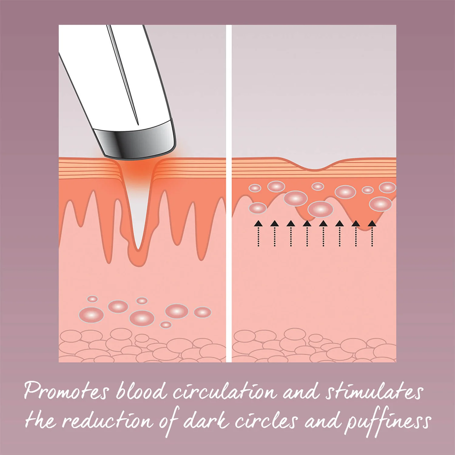 HoMedics Eye Revive Luxe 6 HoMedics Eye Revive Luxe - Image 6