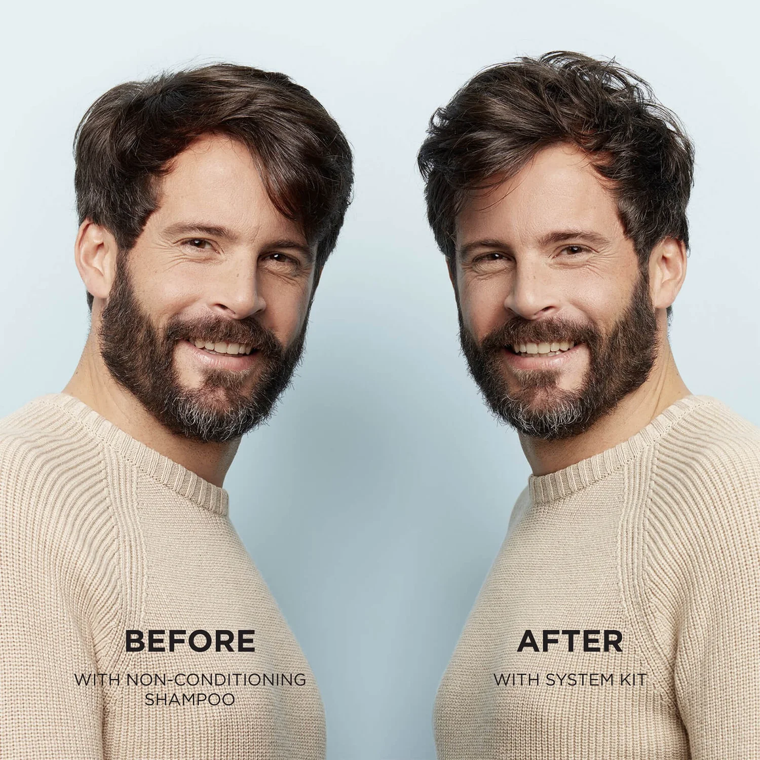 NIOXIN 3-Part System 1 Scalp Therapy Revitalising Conditioner For Natural Hair With Light Thinning 300ml 7 NIOXIN 3-Part System 1 Scalp Therapy Revitalising Conditioner For Natural Hair With Light Thinning 300ml - Image 7