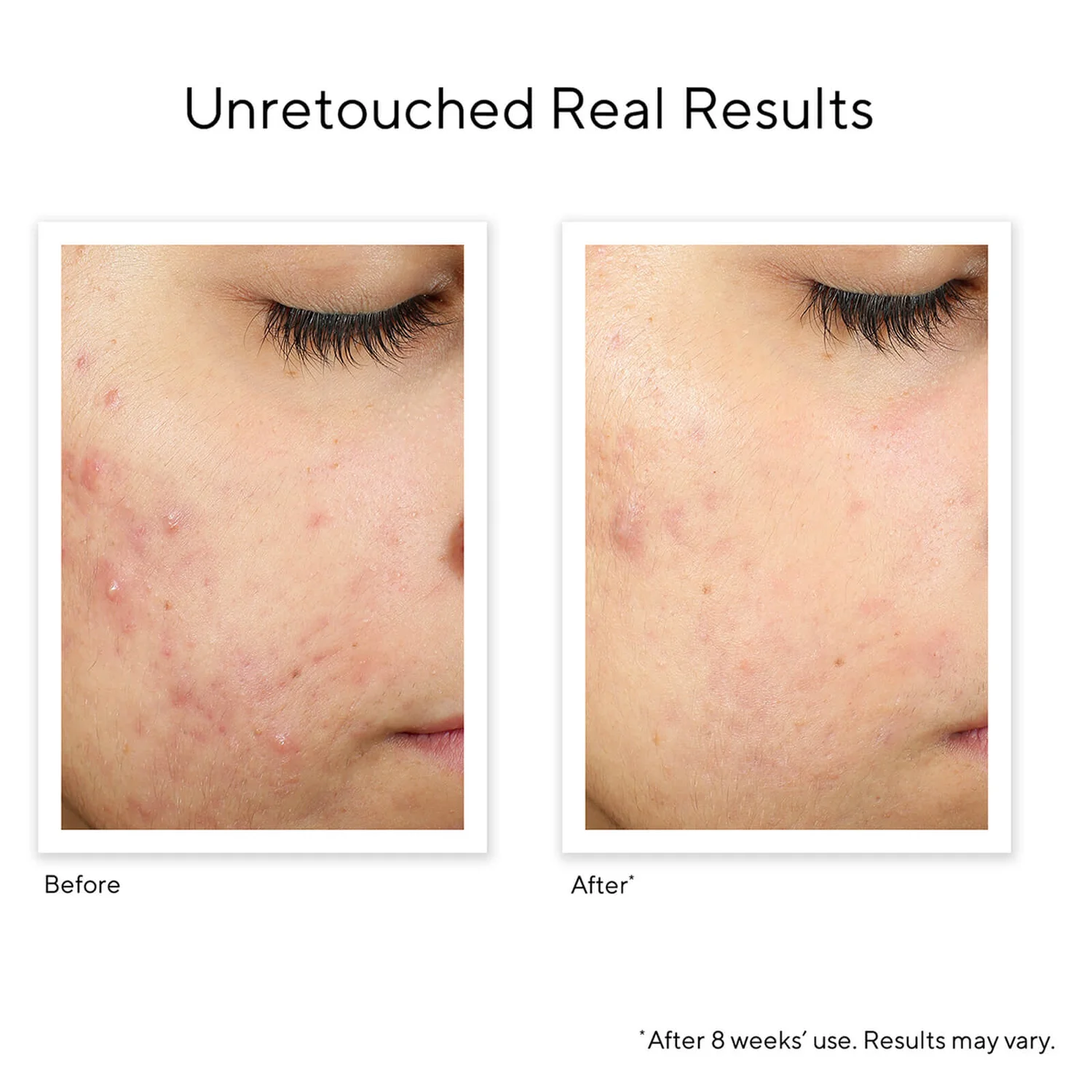 Murad InvisiScar Resurfacing Treatment 15ml 4 Murad InvisiScar Resurfacing Treatment 15ml - Image 4