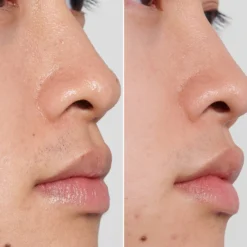 The INKEY List PHA Toner 100ml -Skincare Store 12276070 6985061808703862