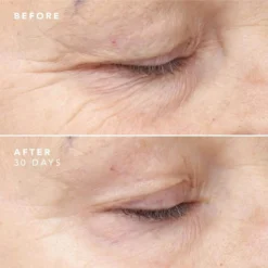 BIOEFFECT 30 Day Treatment 3 X 5ml -Skincare Store 12434372 7184821040614282