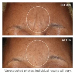 StriVectin SD Advanced PLUS Intensive Moisturising Concentrate 118ml -Skincare Store 12528621 1654886105949072