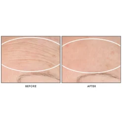 StriVectin SD Advanced PLUS Intensive Moisturising Concentrate 118ml -Skincare Store 12528621 1734980889853454